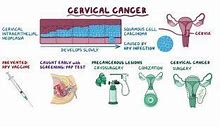 Image result for Causes of Genital Warts