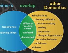 Image result for Dementia vs Alzheimer's Symptoms