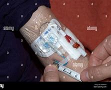 Image result for PICC Line Catheter Measurement