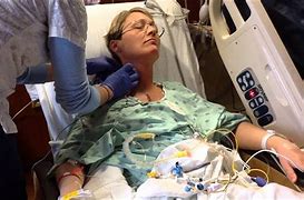 Image result for People Recovering After CPR