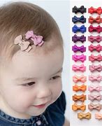 Image result for Plastic Snap Clips