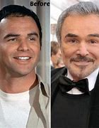 Image result for Burt Reynolds without Wig