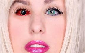 Image result for Surgery Eye Color Permanent