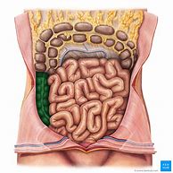 Image result for 35 Cm of Colon