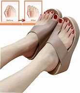 Image result for Orthopedic Sandal Slippers for Women