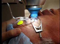 Image result for Laser Cataract Surgery