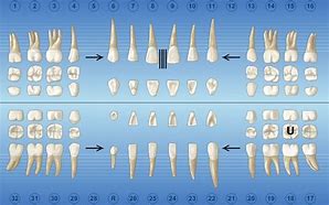 Image result for Retained Tooth Charting