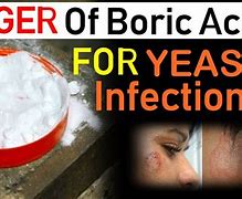 Image result for Boric Acid Yeast Infection