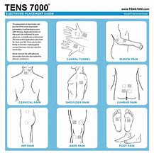 Image result for Tens Unit Placement