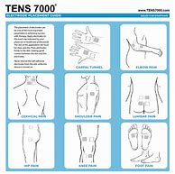 Image result for Tens Unit Pad Placement Chart