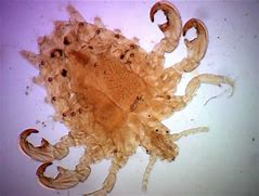 Image result for STD Called Crabs