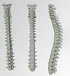 Image result for Back Brace for Curved Spine