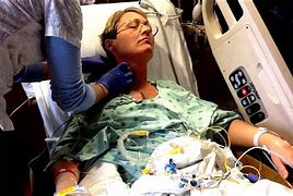 Image result for Open Heart Surgery Valve Replacement Recovery