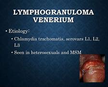 Image result for Genital Ulcers Male
