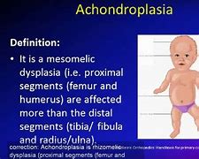 Image result for acobdropl�sico