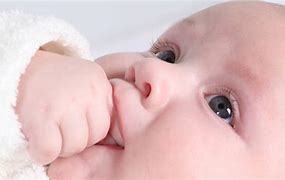 Image result for Keratosis Pilaris Baby