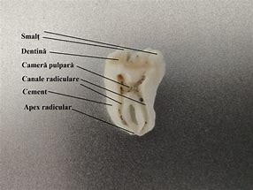 Image result for denticulaci�n