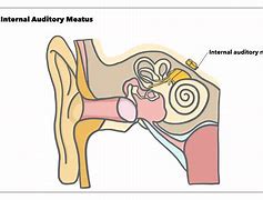 Image result for Internal Acoustic Meatus Bone