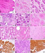 Image result for Canine Papilloma