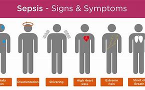 Image result for Sepsis Syndrome