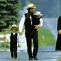 Image result for Microcephaly Amish