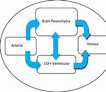 Image result for Hydrocephalus Signs