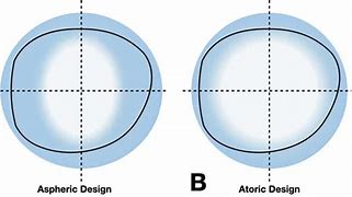 Image result for Atoric Lens Design