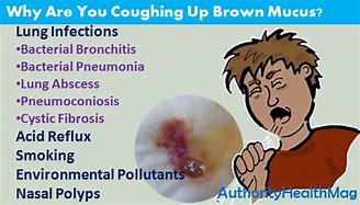 Image result for Coughing Up Brown Phlegm