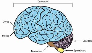 Image result for Brain without Hemispheres