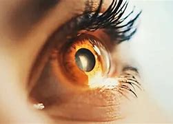 Image result for Myopia vs Normal Eye