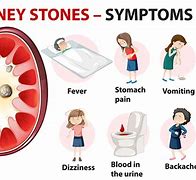 Image result for Kidney Stone Disease Symptoms