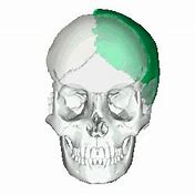 Image result for Skull Bones Labeled Sutures