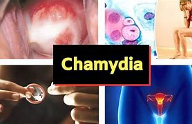 Image result for Chlamydia