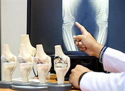 Image result for Orthopedic Knee Surgery