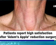 Image result for Death Adam S Apple's