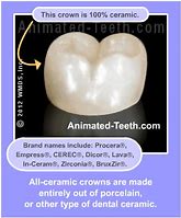 Image result for Tell Difference Between Porcelain and Ceramic