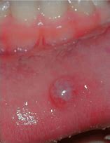 Image result for Stray Kids Lips