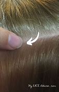 Image result for Lice in Blonde Hair