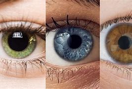 Image result for Barva OCI Heterochromia