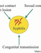 Image result for Syphilis Transmission