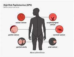 Image result for Genital Human Papillomavirus Women