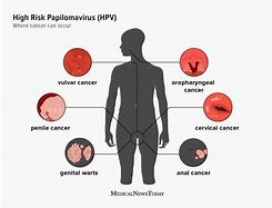 Image result for Human Papillomavirus Transmitted