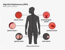 Image result for Human Papillomavirus 6