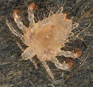 Image result for Crabs STD Pics