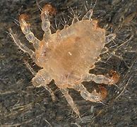 Image result for Pic of Crabs STD