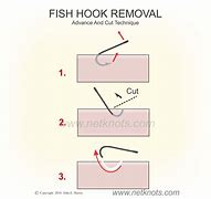 Image result for Illustration to Remove Fish Hook