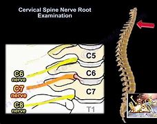 Image result for Nerves Coming Out of Cervical Spine