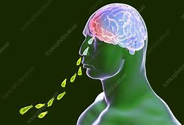 Image result for Brain Parasites in Humans