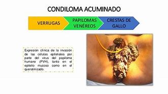 Image result for acuminadp