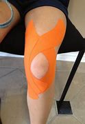 Image result for Patellofemoral Pain Syndrome Taping